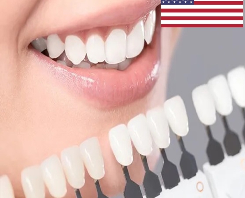 لمینت دندان امریکایی