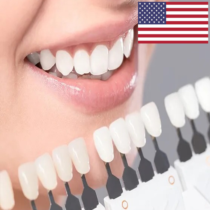 لمینت دندان امریکایی