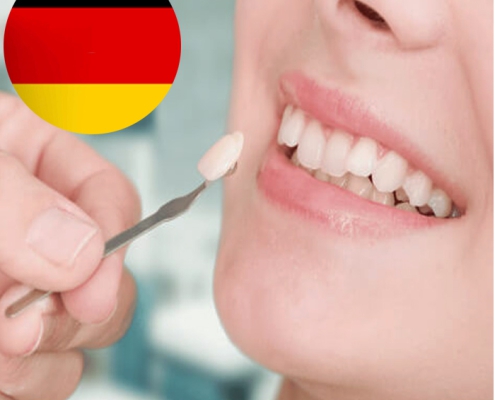 لمینت دندان آلمانی