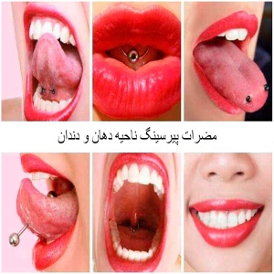 مضرات پیرسینگ ناحیه دهان و دندان