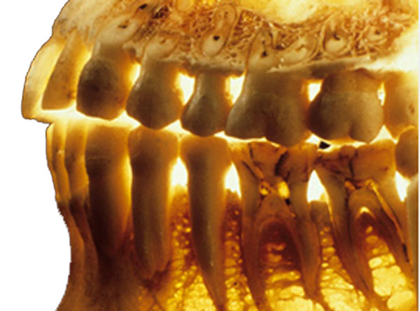 پوکی استخوان فک چه تاثیری بر سلامت دندان
