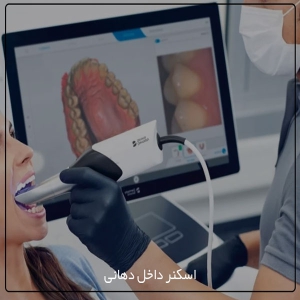 مزایا و کاربردهای اسکنر سه بعدی در دنداپزشکی