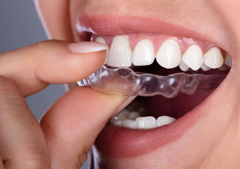 روش درمان، عوامل و علائم حساسیت دندان