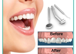 کانتورینگ یا تراش و تغییر شکل مینای دندان