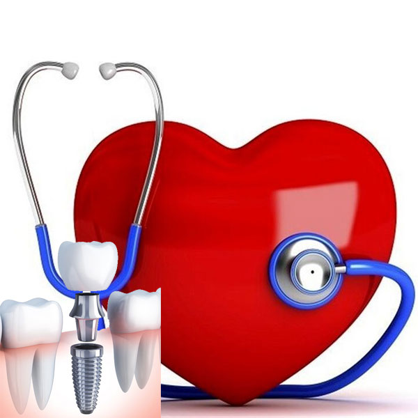 کاشت ایمپلنت دندان در بیماران مبتلا به مشکلات قلبی