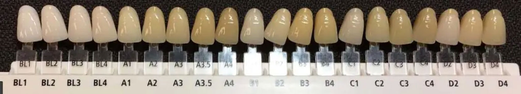 انواع درجه بندی رنگ لمینت دندان